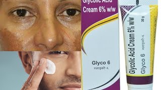 Glycolic acid cream  Glycolic acid 6  cream review Bengali Glyco 6 [upl. by Nisse]