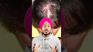 Jatamansi Hair Growth Remedy Natural Solution for Stronger Roots amp Regrowth reducehairfall [upl. by Ratib975]