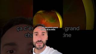 Décollement de rétine retine ophtalmologie sante medecine urgence youtubeshorts ytshorts [upl. by Rennold]