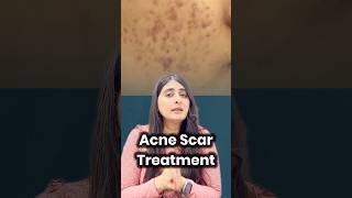 acne scar treatment  how to get rid of acne scars  silicon creams  retinoids  silicon for scars [upl. by Sidras]