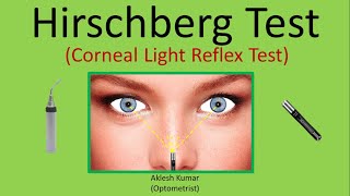 Hirschberg Test  Corneal Light Reflex Test  CLR  HBRT [upl. by Ardyth]