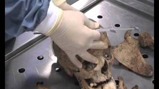 Antropologia Forense0003wmv [upl. by Ais]