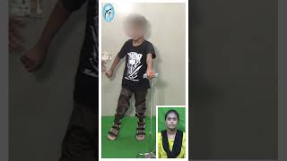 Dyskinetic cerebralpalsy child managed by therapy amp brace at trishla [upl. by Nove]