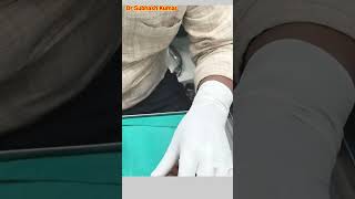 How Lignocaine Is Given Xylocaine कैसे दिया जाता है drsubhashkumar anaesthesia [upl. by Blancha]