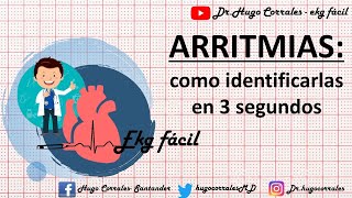 ARRITMIAS CARDÍACAS  como identificarlas en 3 segundos [upl. by Alexi]