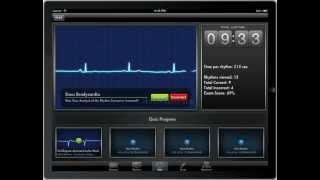 ACLS Rhythms  Resuscitation Guidelines [upl. by Akkin59]