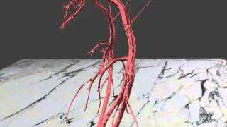 Whole aorta 3D rendering [upl. by Remas]