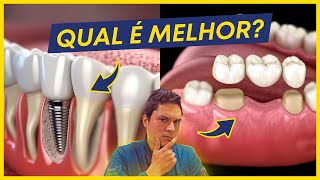 IMPLANTE DENTÁRIO X PRÓTESE FIXA QUAL É MELHOR A VERDADE [upl. by Benioff255]