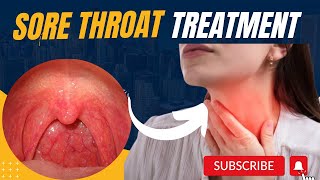 How to get rid of Sore throat  Sore throat remedies sore throat treatment  sore throat MHCP [upl. by Ecirtnahc197]