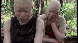 Deadly Hunt Albinos in Tanzania [upl. by Oiludbo374]