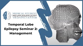 Temporal Lobe Epilepsy Seminar 2 Management [upl. by Teyugn]