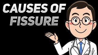 Causes of Fissure [upl. by Dickey646]