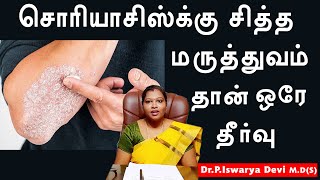 Psoriasis siddha treatment in tamil  DrPIswarya Devi MDSiddha [upl. by Notsuh894]