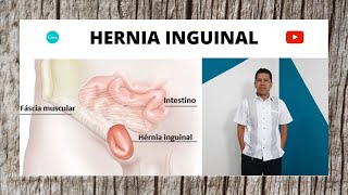 HERNIA INGUINAL RECUPERACIÓN Y DOLOR DESPUÉS DE LA CIRUGÍA [upl. by Eirak]