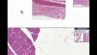 Histopathology Skeletal muscleAtrophy [upl. by Tavish]