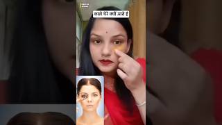 dark circles under eyes home remedy। dark circle removal। Dark circle treatment beautyhacks shorts [upl. by Marget821]