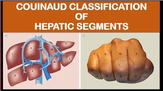 Anatomy of hepatic segments [upl. by Adnawed]