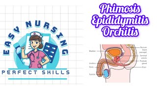 Phimosis  Epididymitis  Orchitis 4th sem [upl. by Enitsirc]