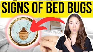 Signs You Have Bed Bugs And How To Get Rid Of Them [upl. by Adnek]