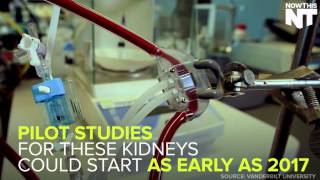 Artificial Kidney Could Free Patients From Dialysis [upl. by Albertine419]