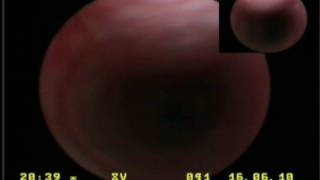 Tracheobronchoscopy in a dog tracheal collapse wwwendovetsu [upl. by Sorcim]