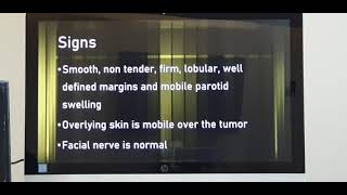 Pleomorphic adenoma Parotid gland Part 1 Patient teaching programme Hindi [upl. by Sivet686]