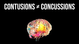 HOW ARE BRAIN CONTUSIONS DIFFERENT FROM BRAIN CONCUSSIONS [upl. by Fulmer961]