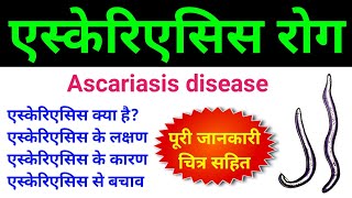 एस्केरिएसिस क्या है  ascariasis class 12  ascariasis microbiology  ascariasis disease in hindi [upl. by Revilo535]