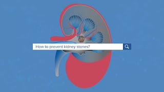 How To Prevent Kidney Stones  Yale Medicine Explains [upl. by Des]