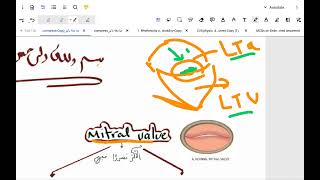 مراجعة مهمه pathology of CVS  Heart valvular disesases  hypetension  atherosclerosis [upl. by Nairret]