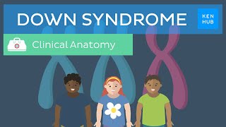 Down Syndrome Definition causes symptoms diagnosis  Kenhub [upl. by Rayford827]