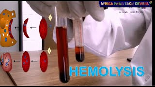 What is hemolysis  what are the causes of hemolysis Hemolysis experiment in vitro [upl. by Ita]