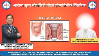 Cured Fistula Patient Treated By Dr Arpit Chopra Jain [upl. by Analram]