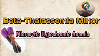 BetaThalassemia Minor ll Microcytic Hypochromic Anemia ll Hematology And Blood Banking [upl. by Eiluj]