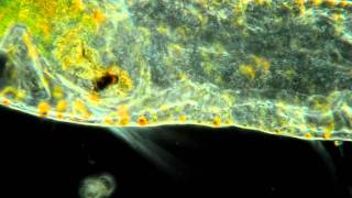 Microscopic Worm With Spinning Food Particle In its Head OMG [upl. by Misa]