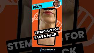 Stem Cells to Face amp Neck🧬✨ [upl. by Onez156]