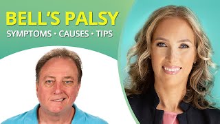 Bell’s Palsy Symptoms Causes amp Tips  Dr J9 Live [upl. by Fatsug]