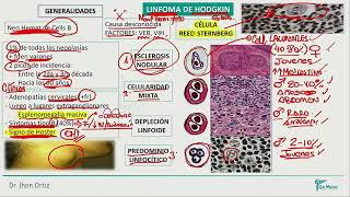 Hematología  Linfoma de hodgkin linfoma no hosgkin mieloma multiple sindrome de lisis tumoral [upl. by Aidan]