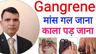 Gangrene best treatment in homoeopathy  गैंग्रीन की सबसे अच्छी होम्योपैथिक दवा । [upl. by Graces994]