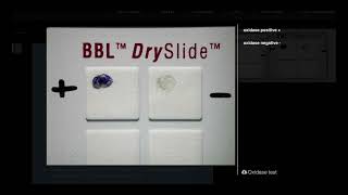 Oxidase Test DrySlide  Microbiology [upl. by Tengdin]