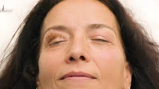 Plexr®  Blepharoplasty Advanced [upl. by Ellynn]